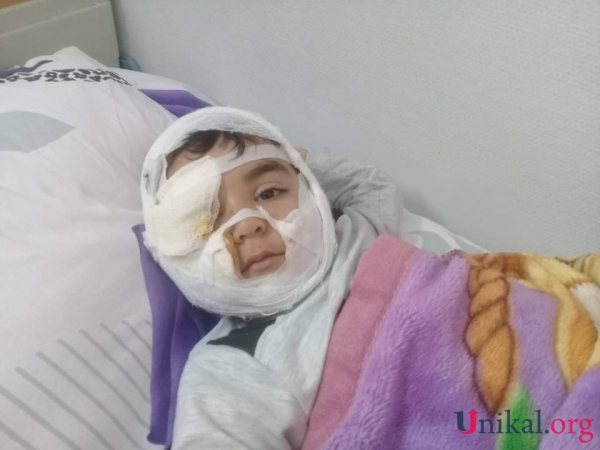 Üzünü it parçalayan uşağın həkimi: Onun yanağı tam bərpa edilib